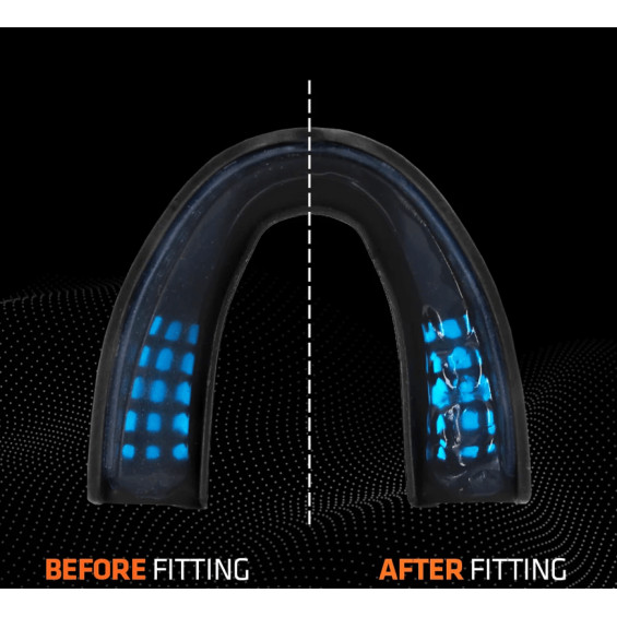 Protege dent Superfit Power SHOCK DOCTOR